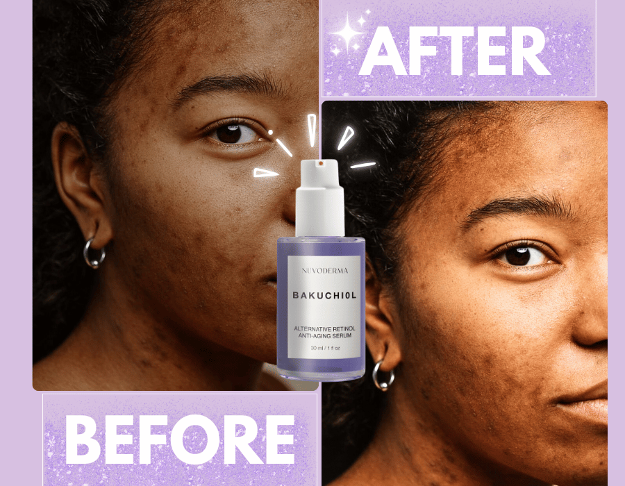 Bakuchiol Serum, Best Retinol Alternative for Firm, Glowing Skin. Smooths fine lines, boosts radiance & deeply hydrates. Try now.