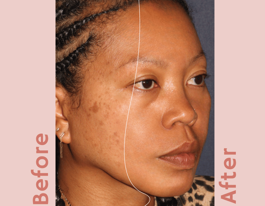 "Kinship Naked Papaya Cleanser | Brightening Enzyme Glow & Deep Hydration | Natural Formula for Radiant Skin | Get Yours Today"